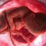 aborto