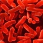 legionella
