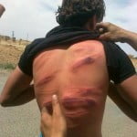 Frustato perchè sorpreso a fumare