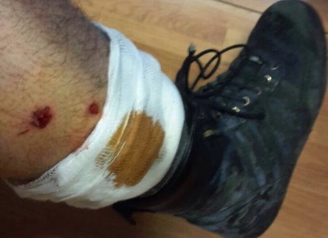 poliziotti-feriti-roma