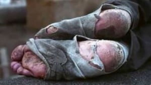 poverta