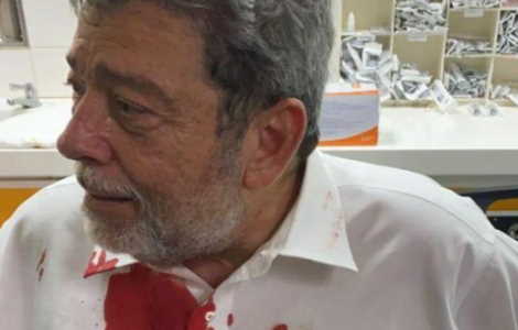 Ministro di St Vincent preso a sassate