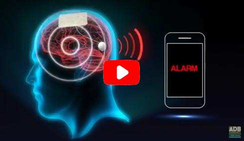 Grafene: dispositivo di connessione cervello-macchina grafene