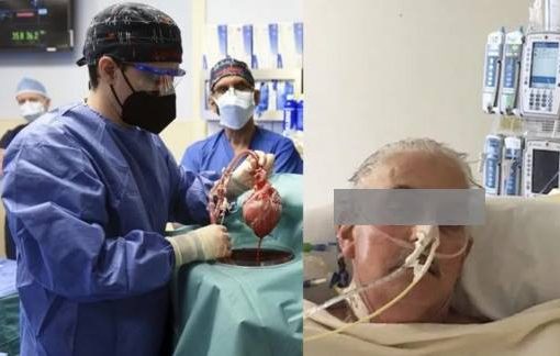 Trapiantato con cuore di maiale