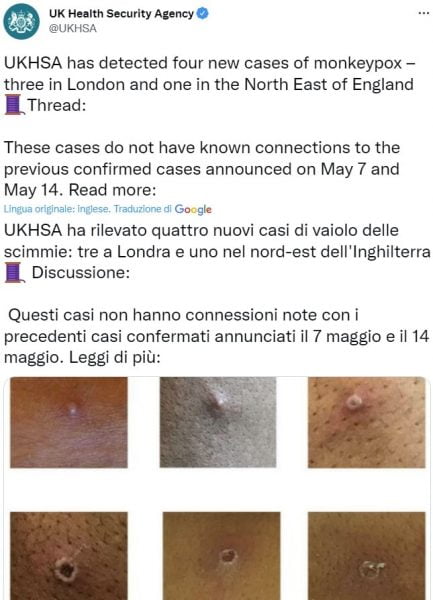 vaiolo delle scimmie