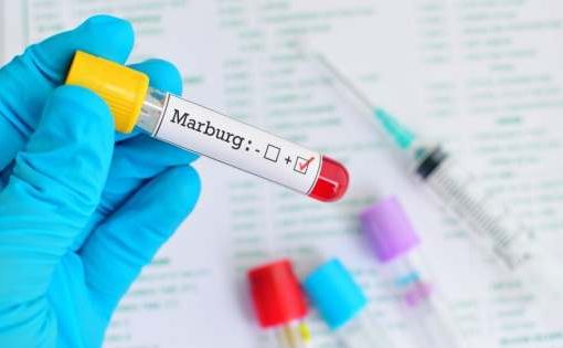 Virus Marburg