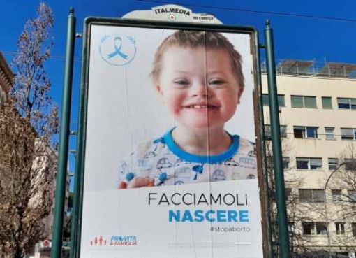 Sindrome Down