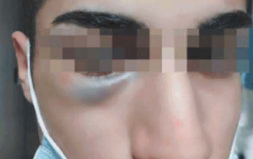 antifascista massacra un 16enne