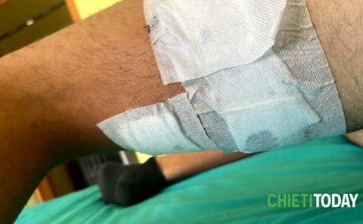 Vasto Marina, lupo aggredisce coppia di fidanzati in spiaggia Lupo aggredisce coppia di fidanzatini