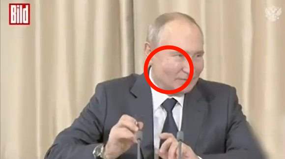 Putin guance gonfiate