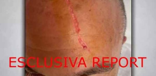 Sangiuliano aggredito da Boccia