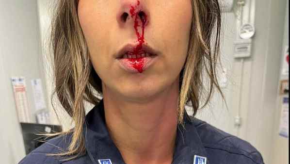 Roma, carcere Minorile Casal Del Marmo: agente colpita con una testata