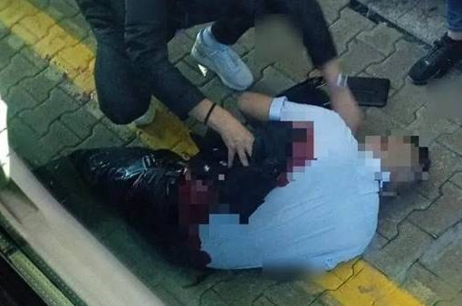 capotreno accoltellato