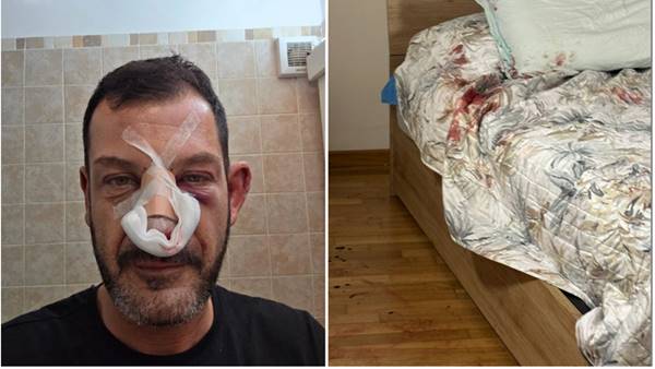 terrore e rapina massacrato in casa da banditi probabilmente dell est europa da Imolaoggi.it terrore e rapina massacrato in casa da banditi probabilmente dell est europa