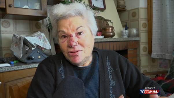 Pistoia, 82enne picchiata e rapinata in casa Pistoia, 82enne picchiata e rapinata in casa