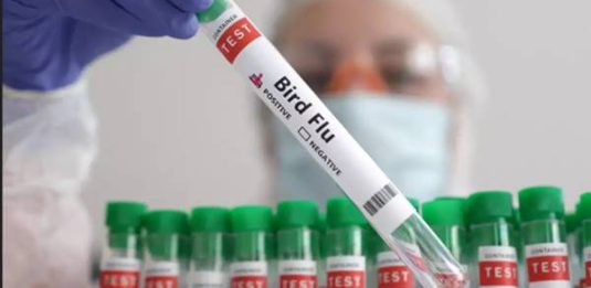 influenza aviaria test