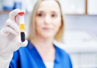 malattie a trasmissione sessuale