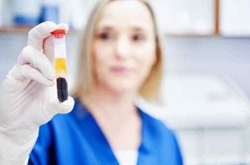 malattie a trasmissione sessuale