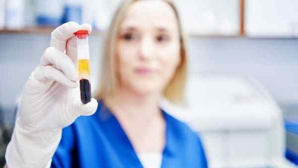 Infezioni sessualmente trasmissibili in aumento in tutta la UE