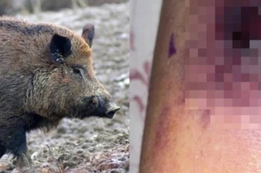 donna aggredita e ferita da un cinghiale