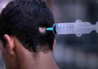 cultura vaccino sperimentale