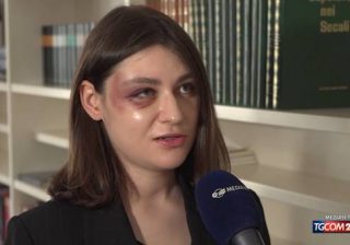 Anna Aksamit, modella polacca molestata e picchiata a Milano