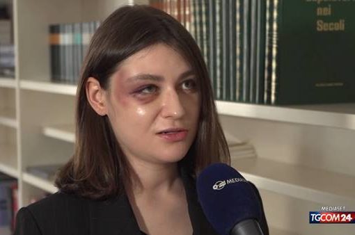 Anna Aksamit, modella polacca molestata e picchiata a Milano