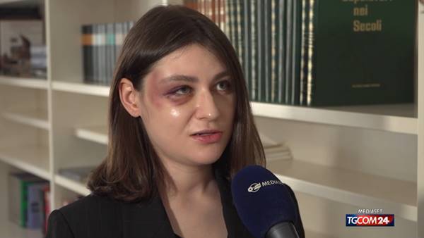 Milano, modella accerchiata e picchiata dal branco: “Volevan